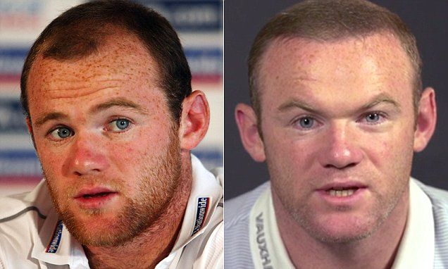 Have you noticed something different about Wayne Rooney's face? |  