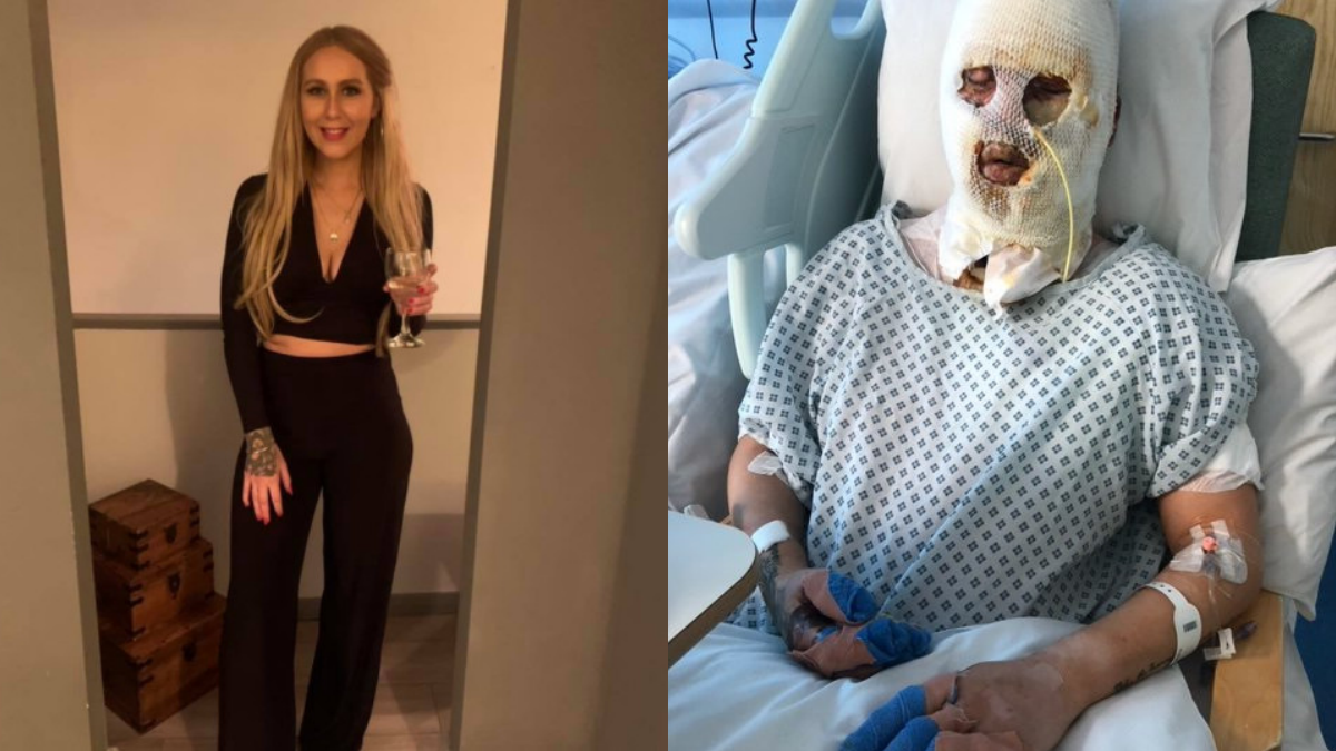 April Charlesworth before and after heater explosion